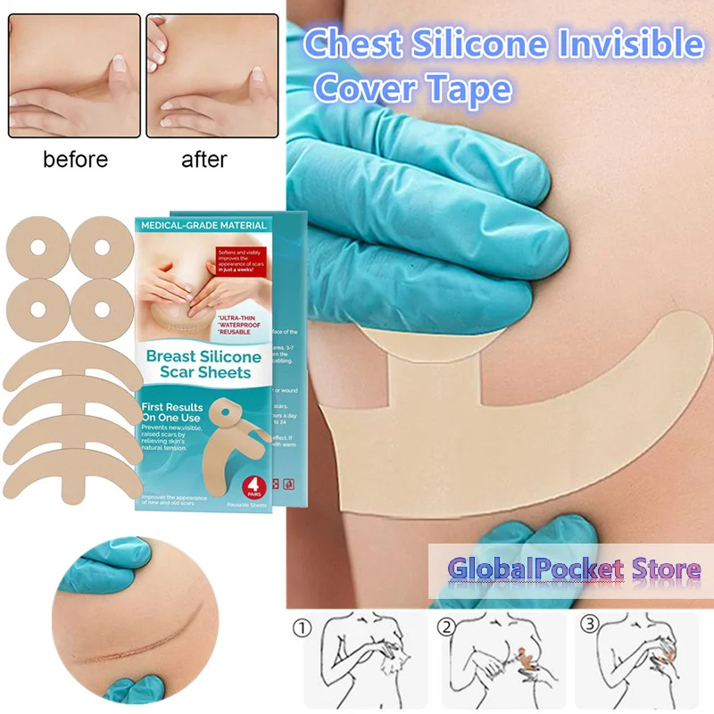 

[TG823]Reusable Silicon Gel Invisible Stickers Circular Arc Chest Invisible Concealer Scar Repair Patch Tattoo Flaw Conceal Tape