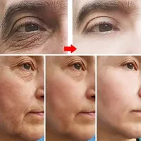 Crème visage anti-rides Sakura, raffermissante, liftante, anti-âge, atténuant les ridules, hydratante, blanchissante, réparatrice, soins de la peau, cosmétiques 2