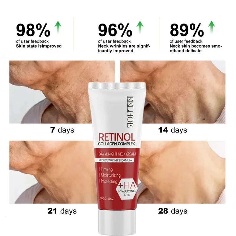 60g Retinol Neck Anti Wrinkle Cream Lift Fade Neck Line Tighten Double Chin Anti Aging Whiten Moisturizer Face Skin Care Product