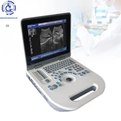 Portable Color Echocardiography Cardiac Machine Ultrasound Scanner