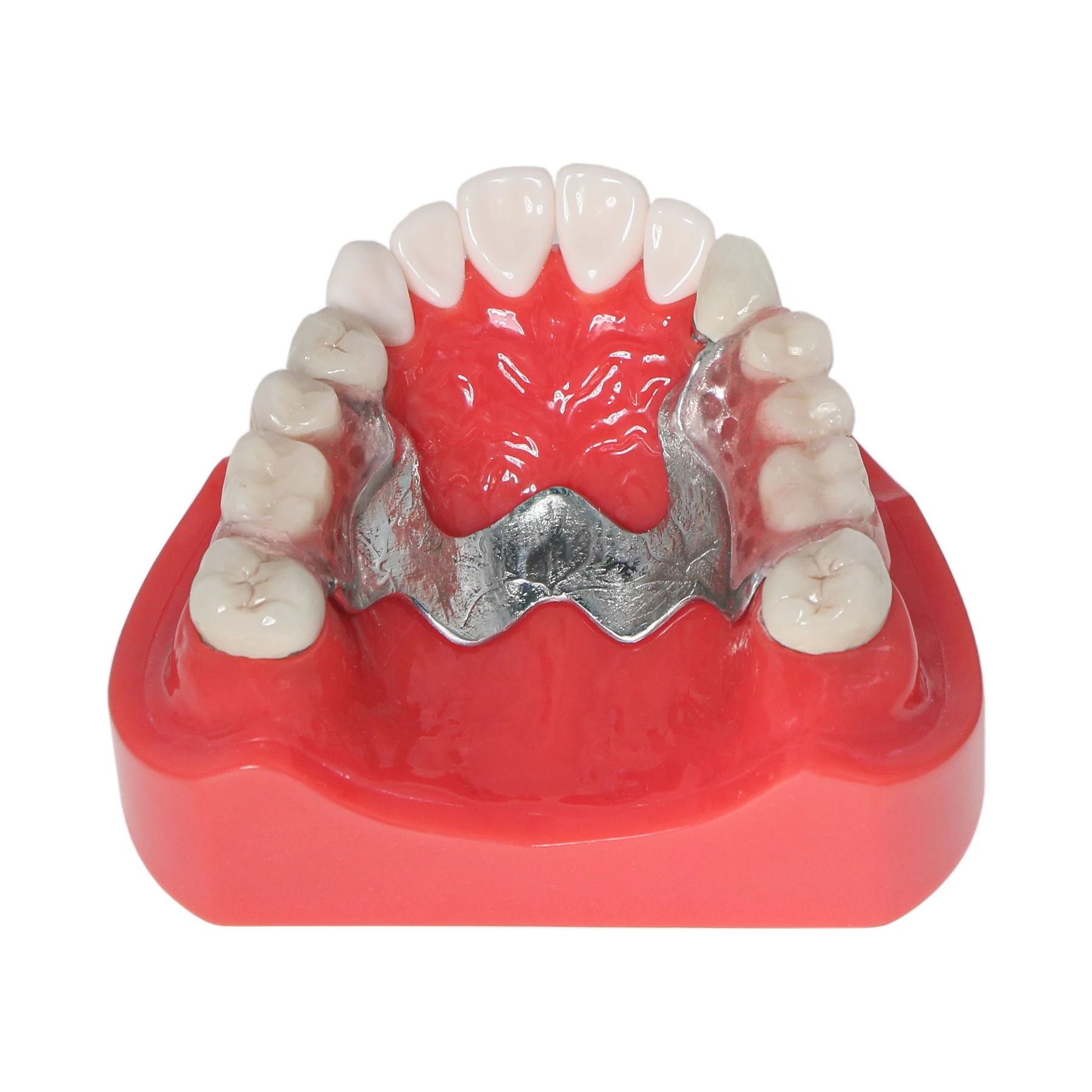 Dental M6010 Telescopic Crown Removable Partial Denture Model Cast Metal Framework Teeth Study Model for Dental School Teaching