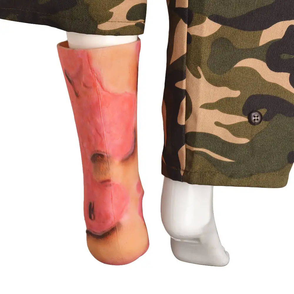 Severe Ankle And Lower Leg Burn Simulation Sleeve for Medical Training And Simulation