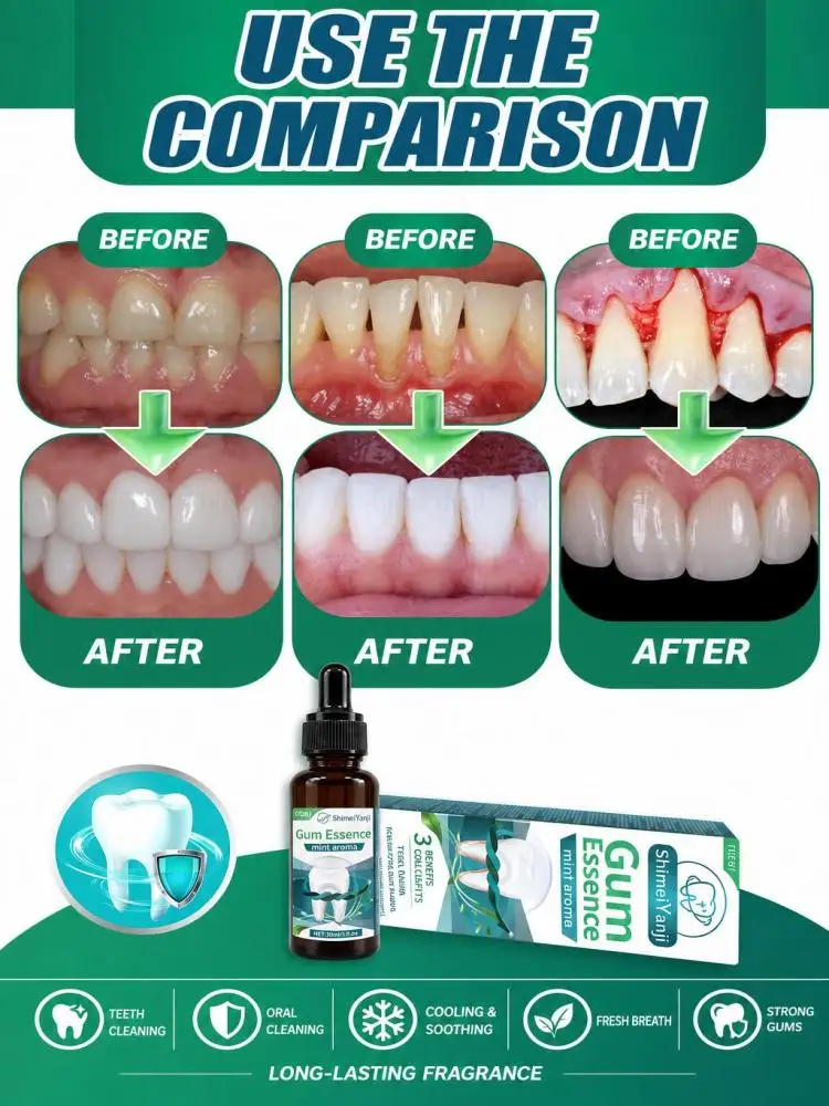 Portable Gum Care Essence Drops, Gentle Formula Cleans Teeth and Oral Surface, Delivers Cool Soothing Sensation, Nurture Gums with Long-lasting Fresh Scent for Daily Oral Care