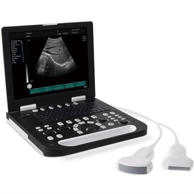 

Factory!Veterinary Portable Cheap Ultrasound Machine Price For Animal Pet Dog Cat Poultry Pigs Horses Sheep