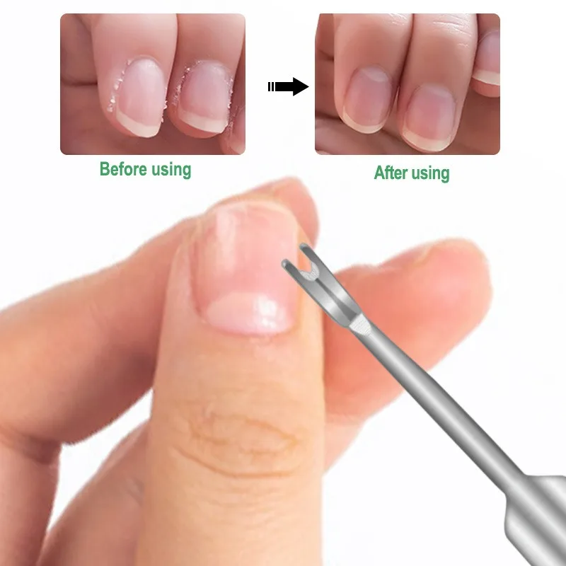 

Средство для удаления кутикулы, толкатель омертвевшей кожи, хирургический класс, нержавеющая сталь, маникюрные инструменты, скребок, очиститель для ногтей, триммер