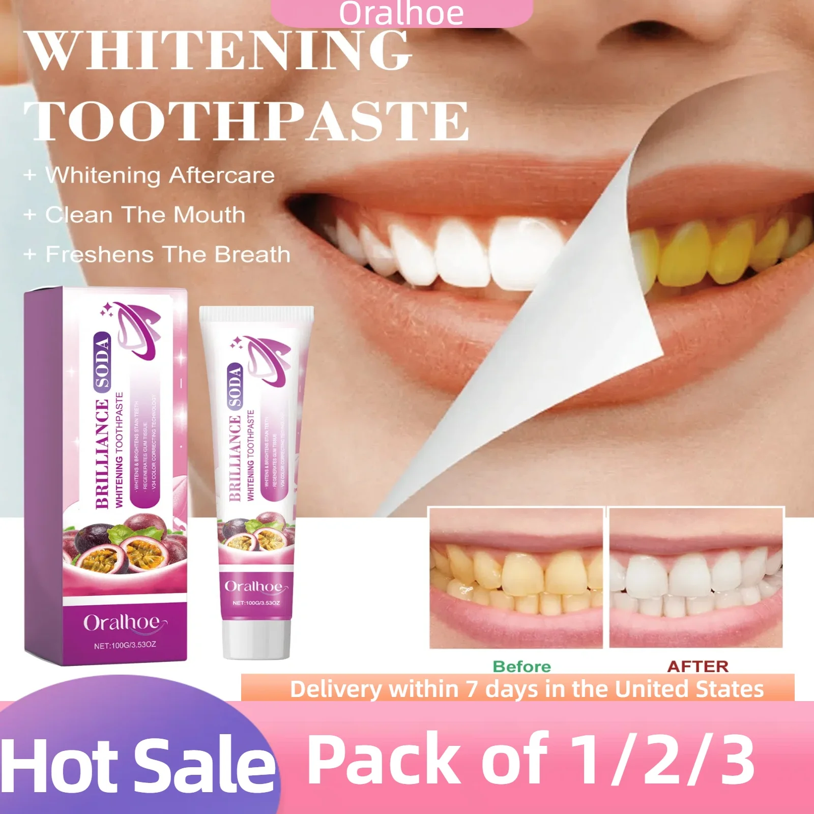 3pcs Passion Fruit Whitening Toothpaste Pigment Decomposition Assistant Improves Tooth Gloss Whitens Teeth,Tea Stain Decomposer