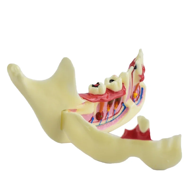 

Dental Model Orthodontic Braces Dental Mandibular Tissue Teeth Demonstration Anatomical Model Study Teach Decomposition Model