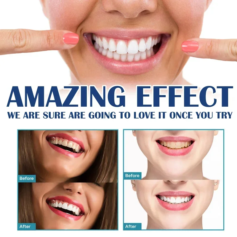 Whitening Tooth Paint para Placa Dentária, Remove Dentes Amarelos, Manchas Brancas, Remoção de Placa, Higiene Oral, Cuidados de Limpeza, Creme Dental