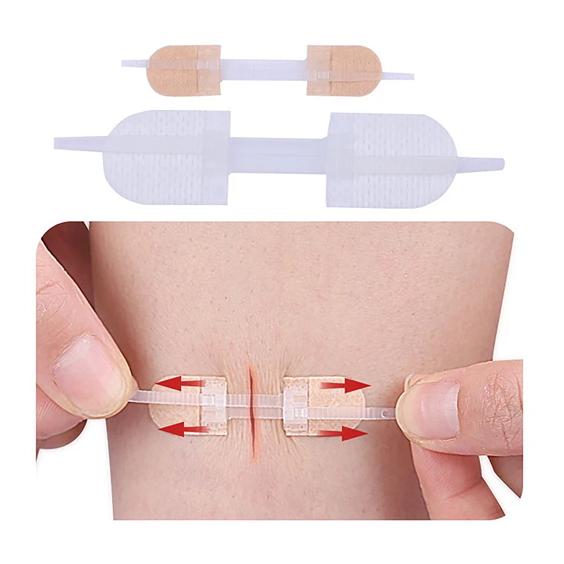 Parche hemostático para cierre de heridas, parche de sutura rápida con cremallera, portátil para exteriores