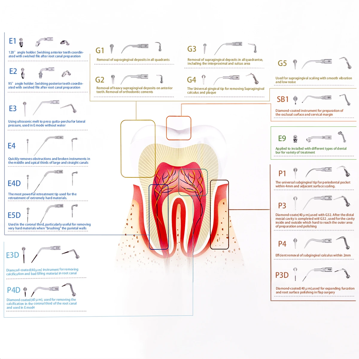 Woodpecker G1/G2/G3/G4/P1 Professional Dental Cleaning and Polishing Tips Set of 5 - High Precision Dental Supplies