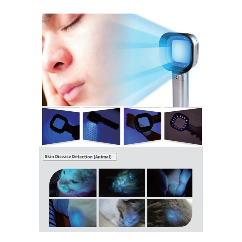 

AA20-2X Woods Lamp Skin Analyzer Portable Facial Salon Beauty Analyzer UV Woods Lamp For Skin Care Analyzing Testing