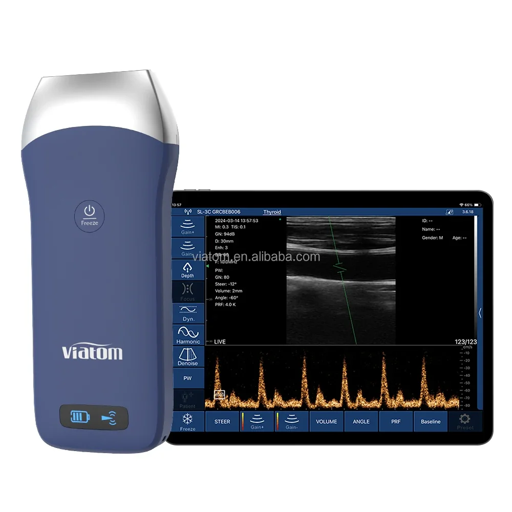 

Viatom 7.5/10mhz Linear Probe Handheld Ultrasound Scanner Working With Phone Portable Ultrasound Scanner