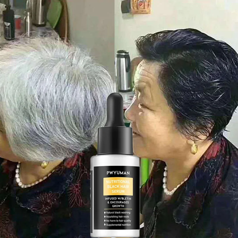 

Natural Black Hair Serum Gray White Hair To Black Repair Nourish Products Loss Hair Damaged Treatment Smooth Care for Men Women