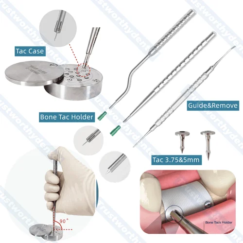 Puntas de hueso Dental GBR, pines de conductor de titanio, caja de membrana, fijación de aleación, estabilización, clavo de cabeza plana, 3,75mm, 5mm