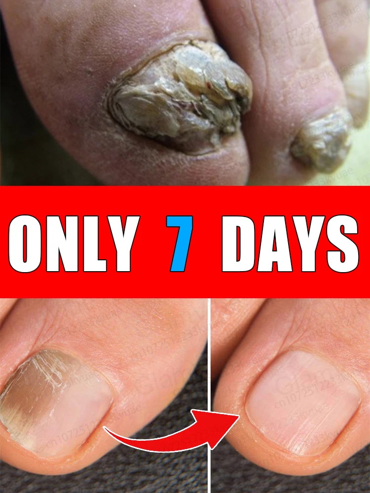 

Quick permeation, nails flawlessly translucent