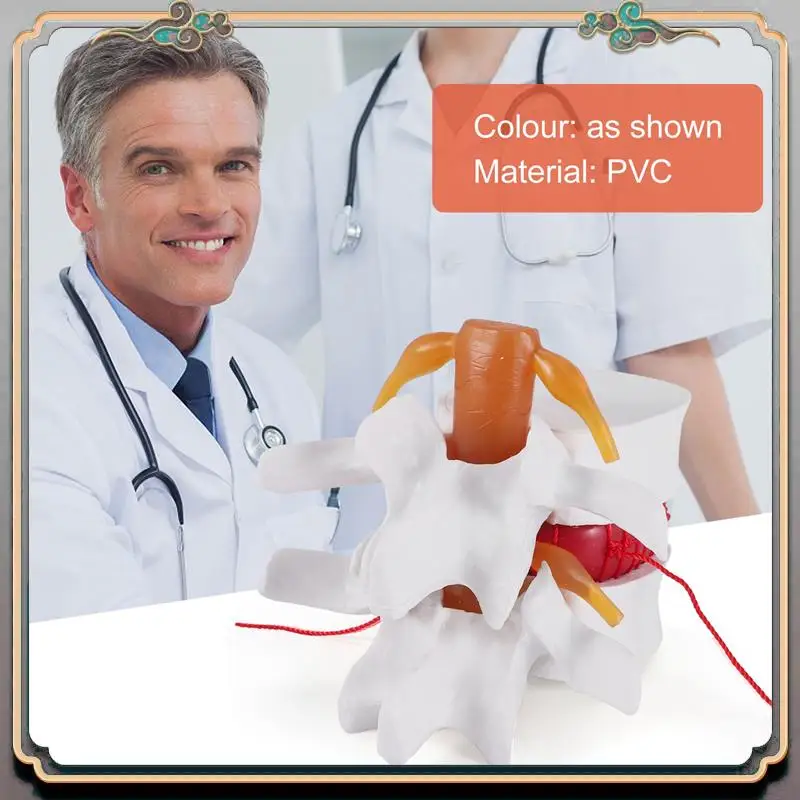 

Durable 1:1.5 Human Lumbar Disc Herniation Demonstration Model Of Lumbar Vertebral Spine Model For Human Anatomy