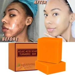 Kójic ácido Facial limpeza sabão Kit, poros, sujeira, acne, cravo, Anti-Acne, remover, controle de óleo profundo, clareamento da pele, 100g