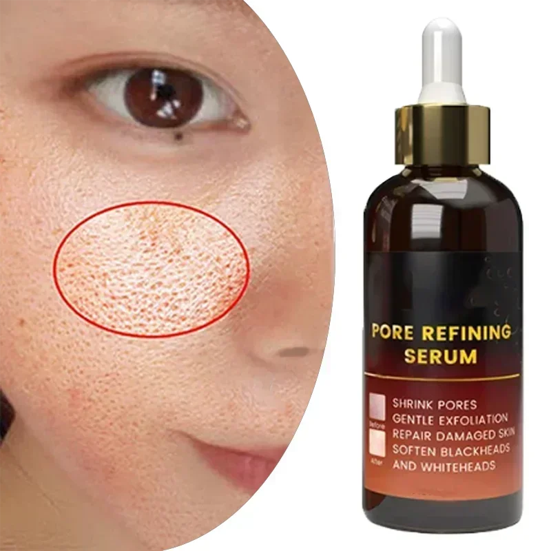 Sérum pour rétrécir les pores du visage, soin de la peau, essence qualifiée ale pour rétrécir les pores, élimination de la sécheresse, hydratant, contrôle du sébum, raffermissant