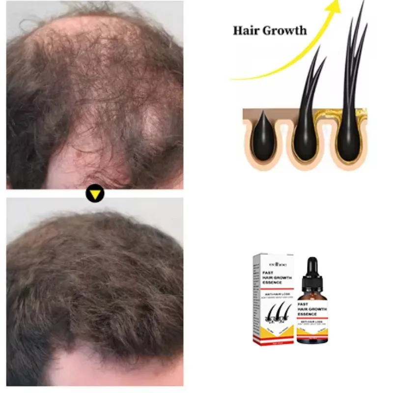 Hair Growth Serum Repair Essential Oil Beauty Hair Care Dense Regrowth Anti Hair Loss Serum Promoting Regeneration.