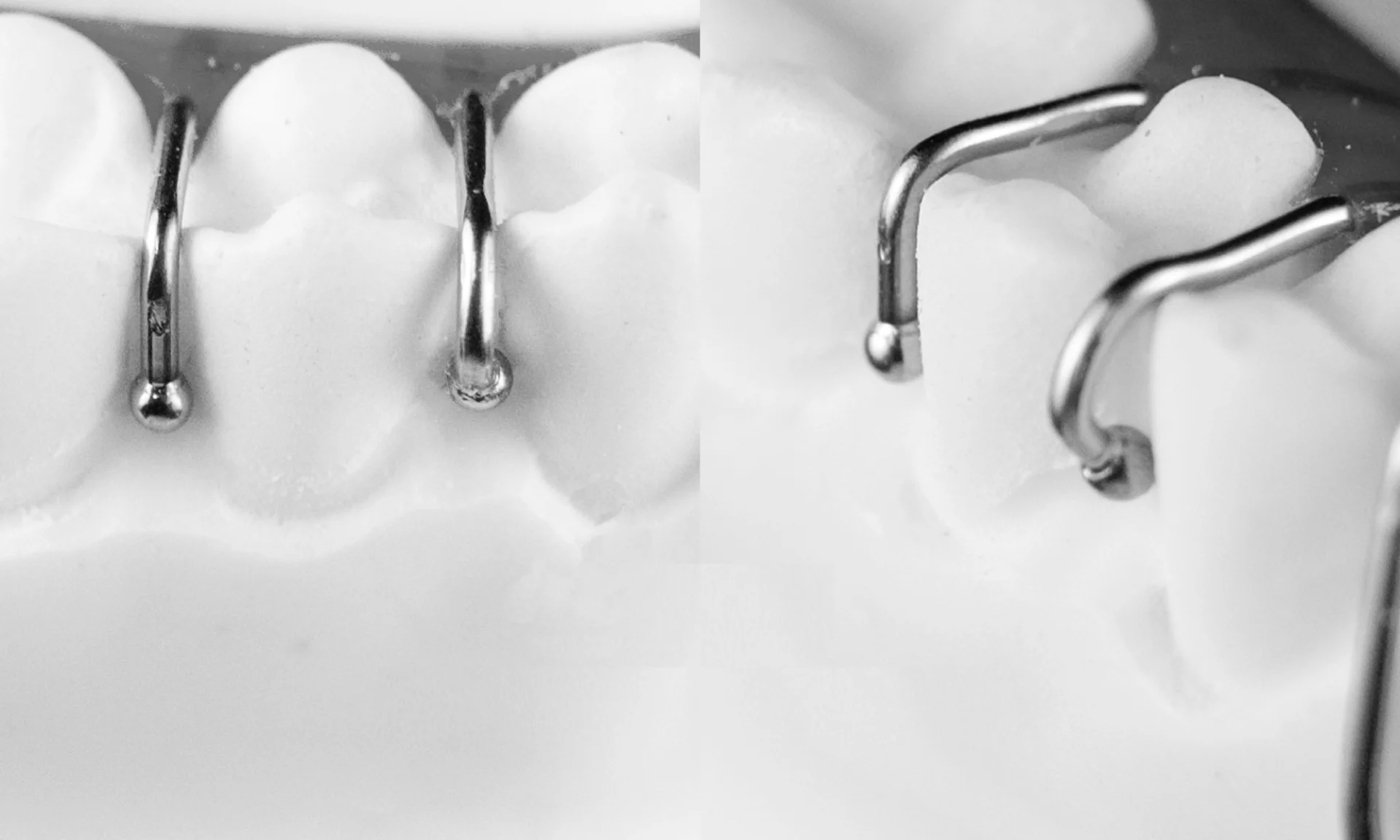 100Pcs Dental Orthodontic Ball Retainer Clasps For Tooth Hold Position 0.7/0.8/0.9mm Germany Leone S.p.a Hooks clasps view 5