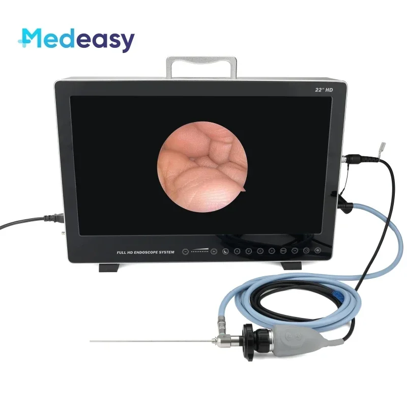 22 Inch Full HD Integrated Endoscope Camera System with HD Medical Monitor and Light Source