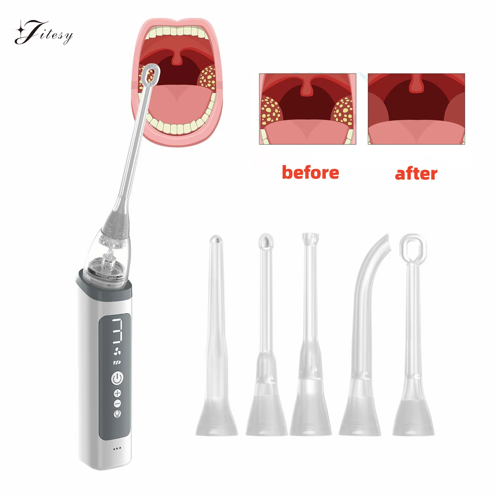 Vacuum Tonsil Stone Remover Tool Built-In LED light  8 Suction Modes Anti Bad Breath Oral Irrigator&Tongue Coating Scraper