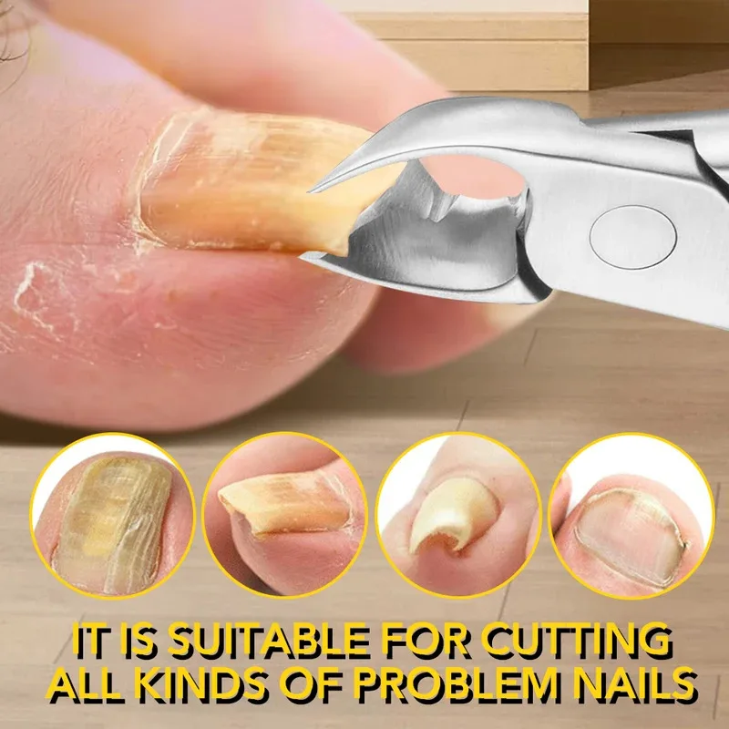 1Pcs Professional Thick Ingrown Toe Nail Clippers Pedicure Nail Cutters Trimmer Curved Blade Grooming Tool