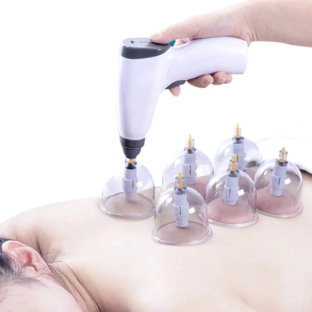 24 Cans Electric Anti Cellulite Suction Cup Massager for Face Body Vacuum Banks Hijama Cupping Therapy Set Guasha Physiotherapy