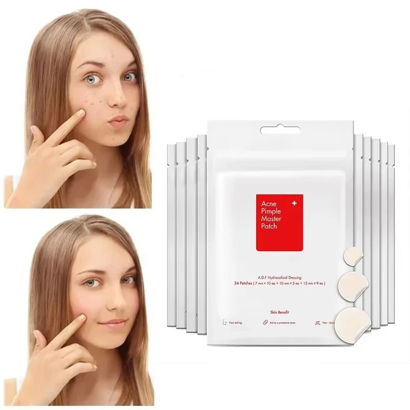 24 pièces visage acné bouton Spot soins de la peau du visage élimination des points noirs patchs de taches de rousseur soins des cicatrices traitement autocollants masque d'acné beauté