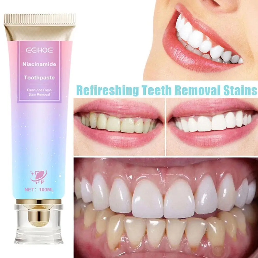 Niacinamida manchas removendo creme dental branco, respiração fresca, cuidados dos dentes, tom de dente, mau hálito, 100g