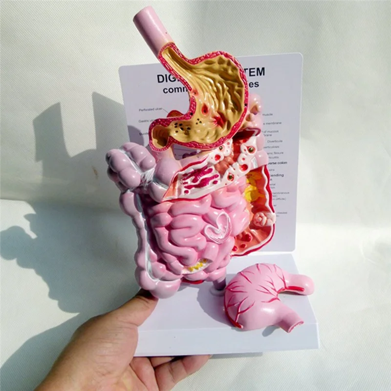 نموذج تشريح الأعضاء الداخلية البشرية الجهاز الهضمي المعدة الأمعاء Cecum Rectum نموذج هيكل الثنائي