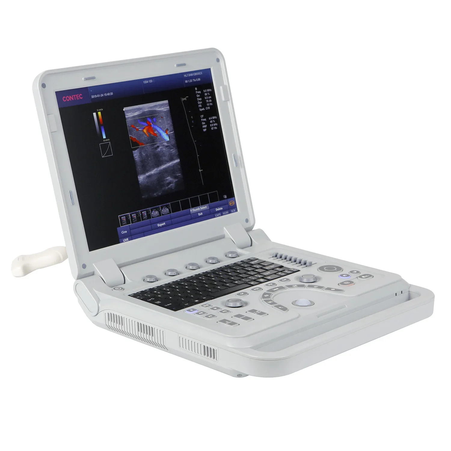 Contec CMS1700B-VET Echografie Machine Prijs Veterinaire Echografie Apparatuur Kleur Doppler Voor Huisdieren