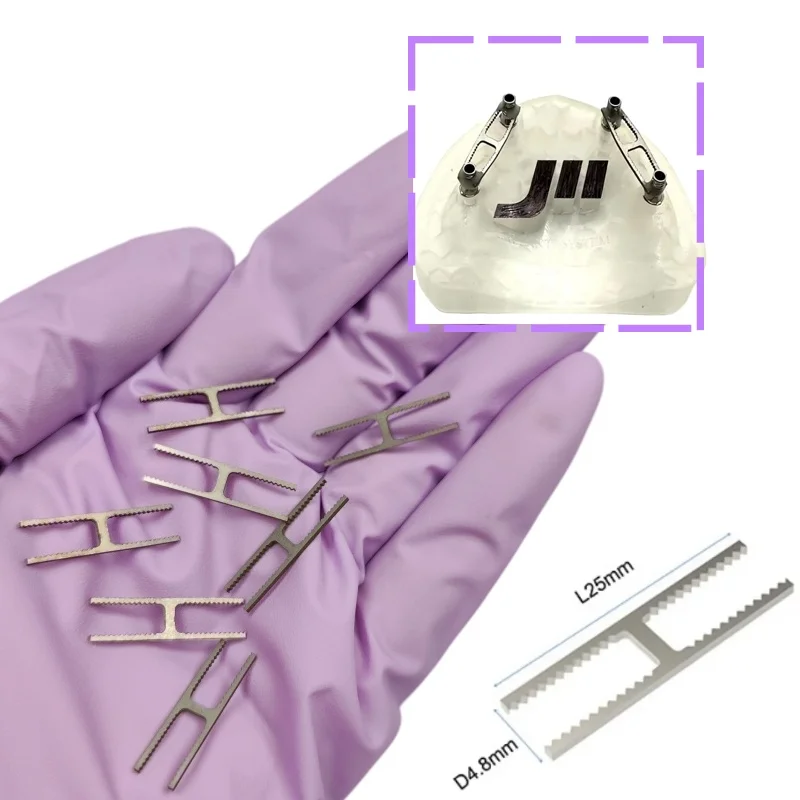 10 Pcs/Bag Dental Implant Impression Reinforcing Bar Fits Straumann& Nobel Temp Bridge & Multi-Implant Analog Connection