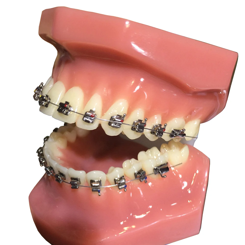 AZDENT Zahnspangen, kieferorthopädische Zahnspangen, Metall, aktiv, selbstligierend, Mini Roth 0,022 Haken, 3–4–5 Bukkalröhrchen, Zahnmedizin-Werkzeug – Detail 6