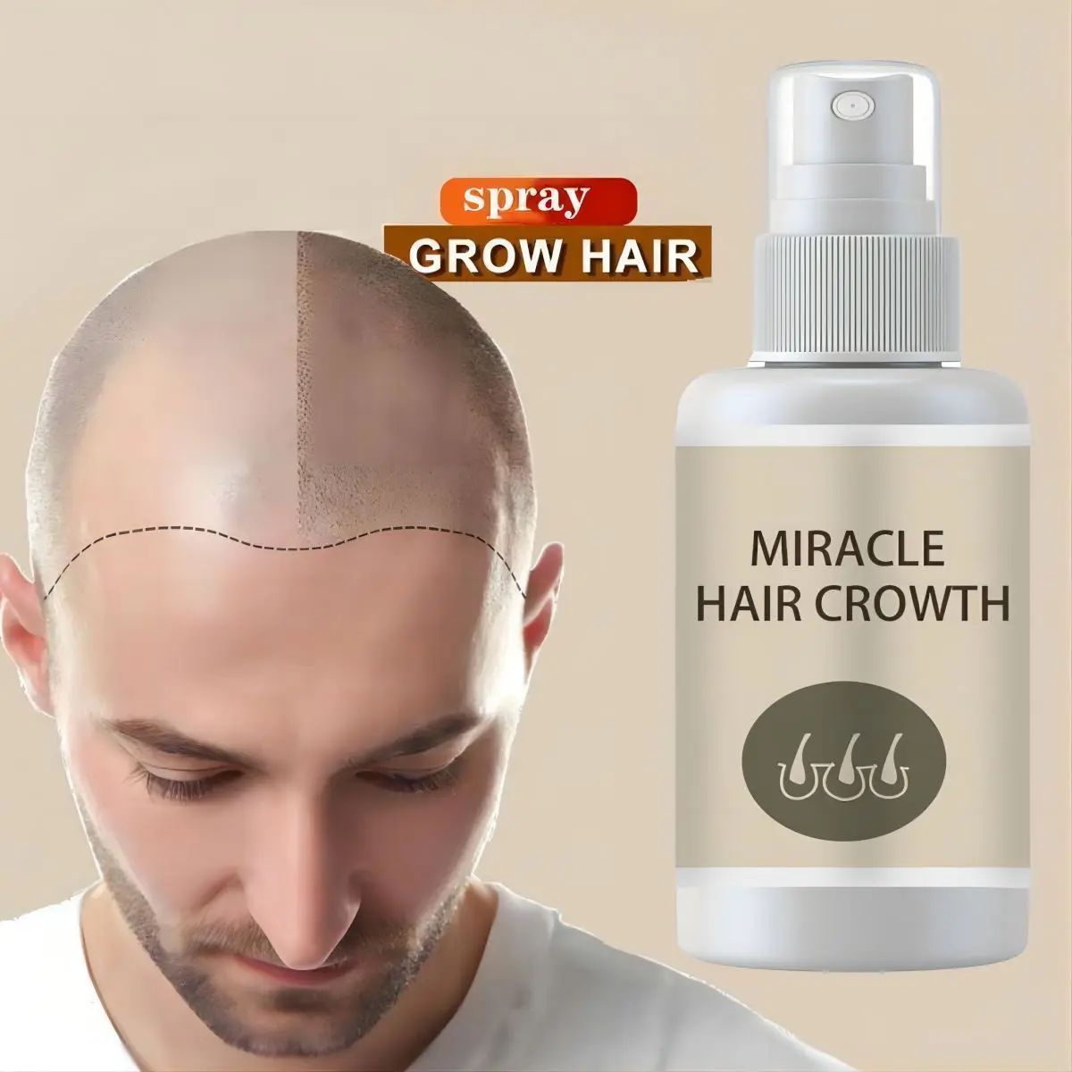 Hair Growth Spray Extract Prevent Hair Loss Growing Hair For Men