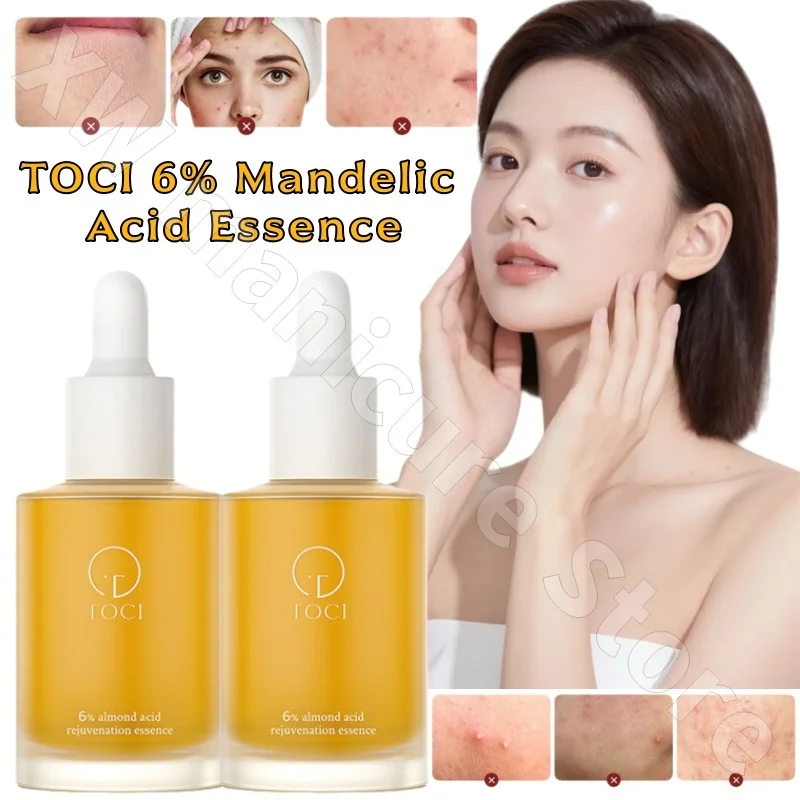 

TOCI 6% эссенция мандельной кислоты удаляет закрытые черные точки, сужает поры, успокаивает и увлажняет эссенцию фруктовой кислоты 30 мл