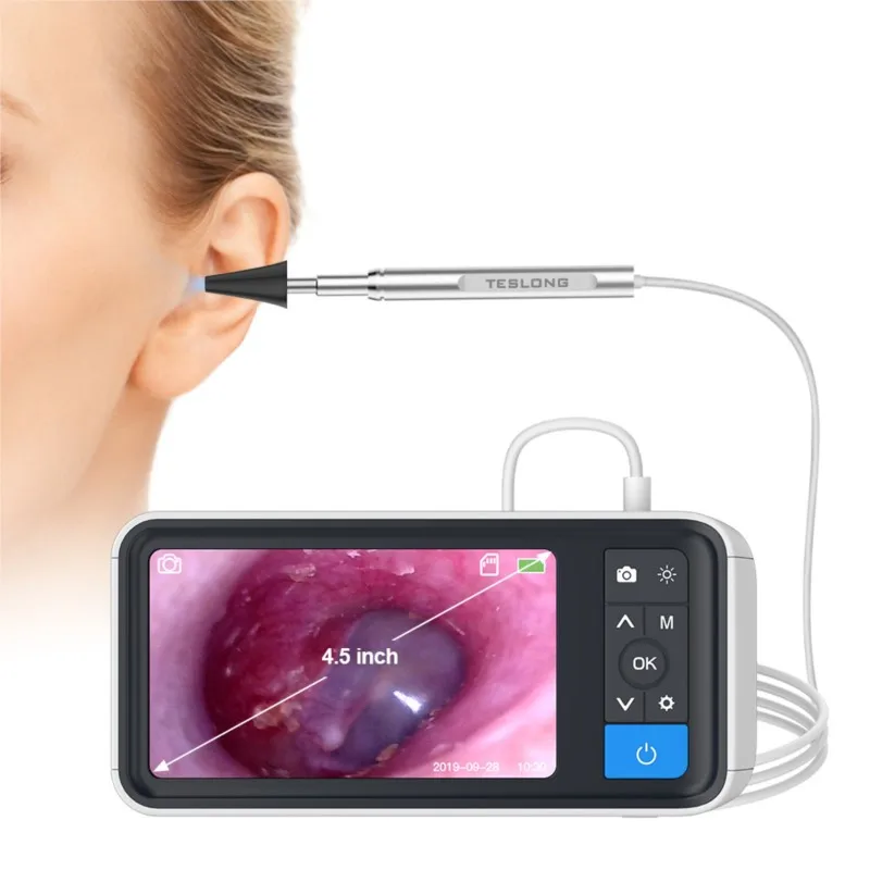 

HD 4.5 Inch Smart Large Screen Otoscope 3.9mm Diameter Otoscope With Screen Visible Ear Spoon