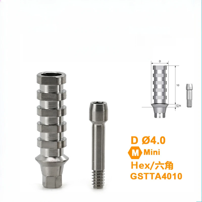 Dental Third Party Accessories Are Suitable for Temporary Screw Implant Replacements with Finished OSSTEM Products - Image 6