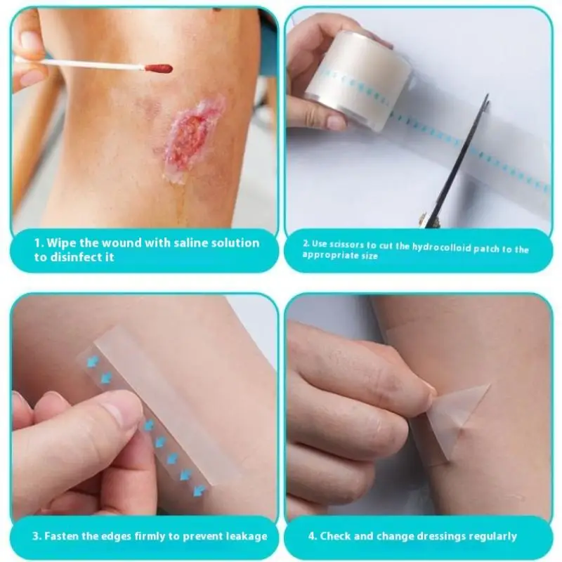 1 rouleau de pansement hydrocolloïde pour un soin efficace des plaies, ruban de couverture de cicatrice auto-adhésif Extra fin, doux et imperméable