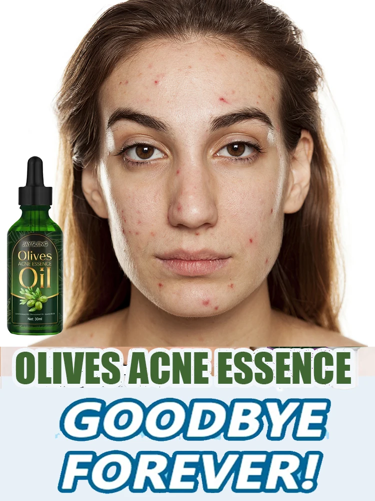 

Skin Care Moisturizing Oil Acne Removal Serum Shrink Pores Oil-Control Brighten Serum,Diminish Acne, Repair Redness