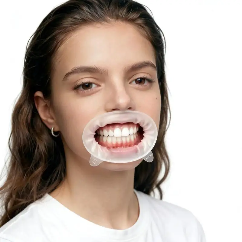 Dentaler Mundöffner 3D Lippen-Wangen-Retraktor O-förmiger Gummi-Expander für orale Untersuchungen und Behandlungsverfahren – Detail 2