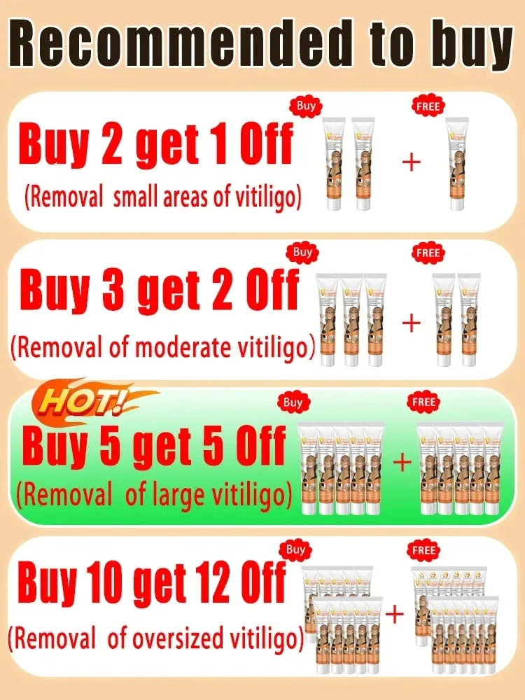 Vitiligo treatment cream Vitiligo relief spray Skin treatment lamp White Spot Removal ointment Eliminate Vitiligo