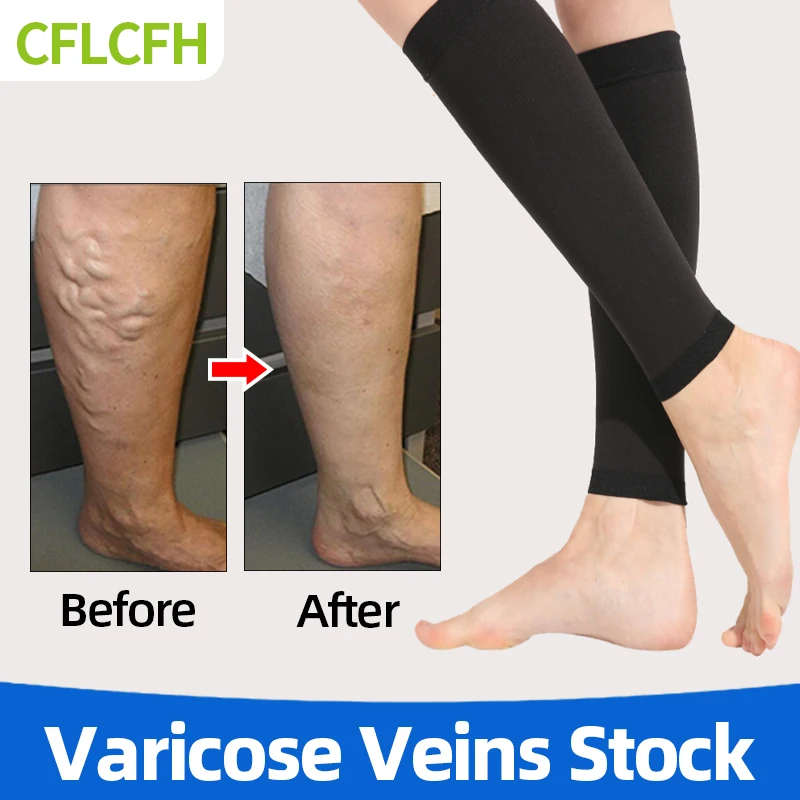 Varicose Veins Medical Socks Vasculitis Phlebittis Spider Legs Treatment Vein Stretch Compression Stockings Black Flesh-Colored