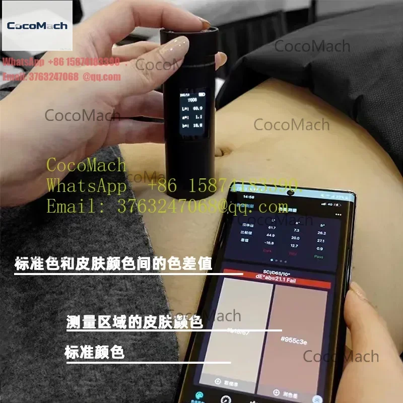 High Precision Digital Color Spectrum Colorimeter For Skin Tone Stretch Marks Growth Line Measurement Testing