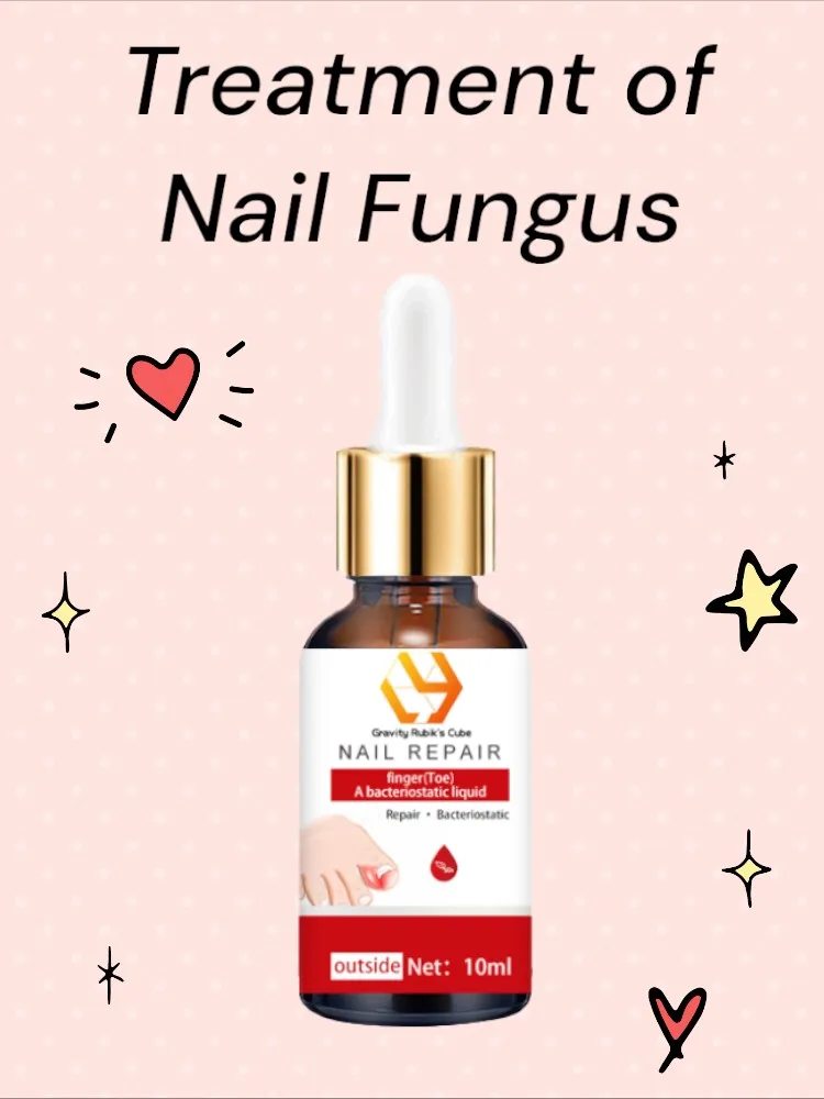 

Nail Fungus Reducing（Buy 2 and get 1 free, buy 3 and get 2 free, buy 5 and get 5 free, support wholesale）