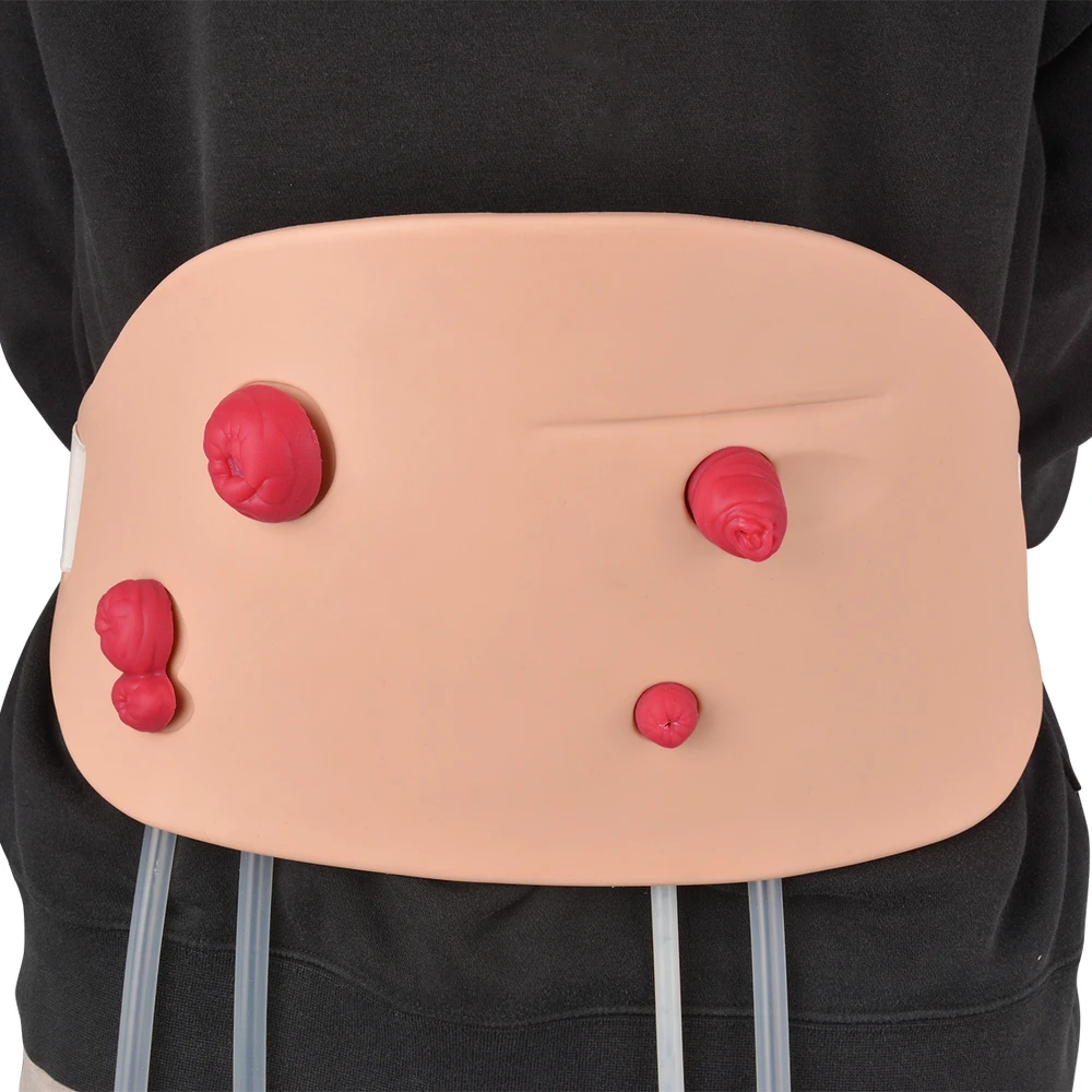 

Wearable Ostomy Stoma Simulator Set, Multi-Skin Tone, Silicon Model