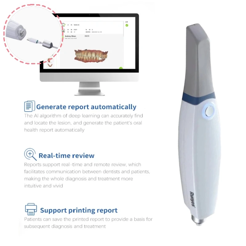 Runyes Dental Intraoral Scanner 3.0 Pro Cyfrowy skaner jamy ustnej 3D z oprogramowaniem Funkcja skanowania AI w prawdziwym kolorze Urządzenie stomatologiczne