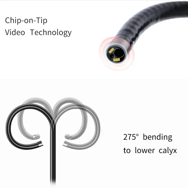 Cystoscope Chip On Tip 275 Degree Bending Disposable Ureteroscope Ureteroscope Urology Endoscope