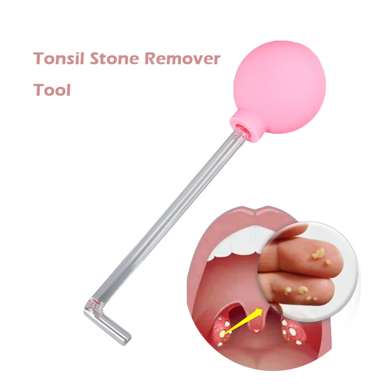 Tonsil Stone Remover Tool Manual Style Remover Mouth Cleaning Care Tool Ear Wax Tonsil Stone Suction Ball Manual Style Cleaner