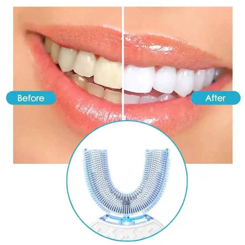Brosse à dents électrique sonique en Silicone en forme de U, nettoyage de la bouche à 360 degrés, brosse à dents automatique, lumière bleue froide
